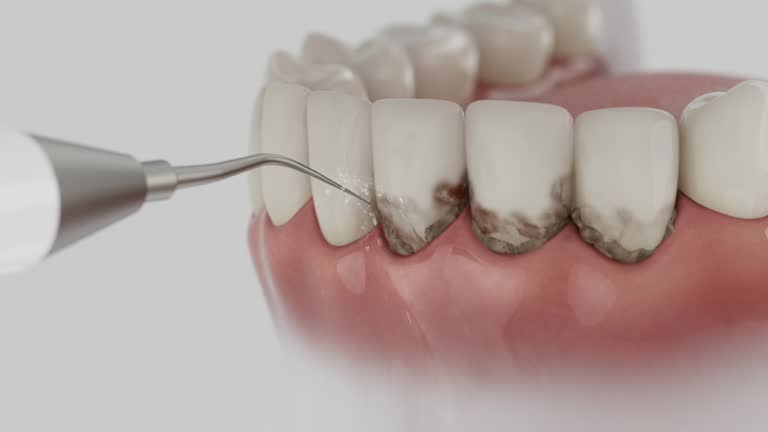 Trusted Dental Implants service in Daisetta, TX - Dentist Open Now